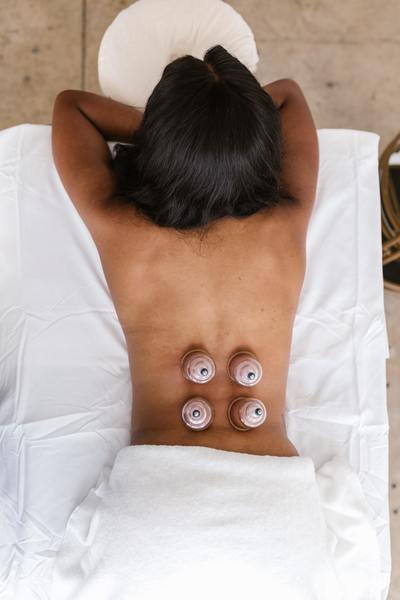 cupping for back pain